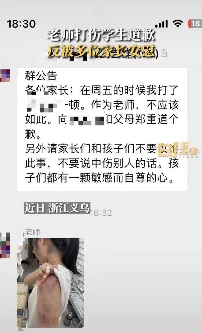 老师打伤学生后道歉