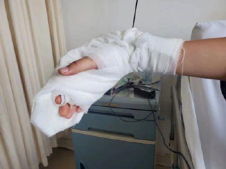 女生摔伤右手苦练左手完成高考