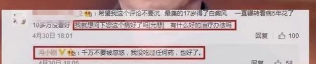 冯小刚白癜风消失了