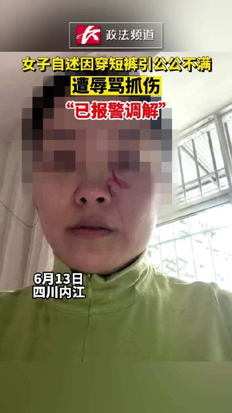 女子自述因穿短裤引公公不满，遭辱骂抓伤：已报警调解