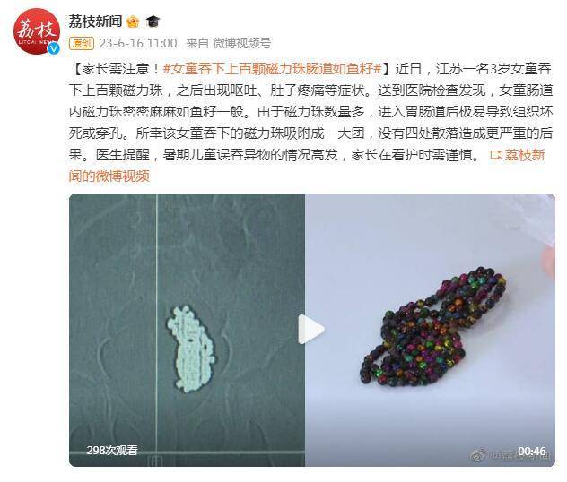 家长需注意！3岁女童吞下上百颗磁力珠肠道如鱼籽

