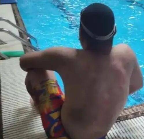 男子满背疙瘩进健身房泳池游泳