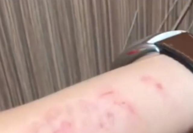 江苏男子遭妻子家暴，拍视频诉苦反被女网友质问：你不反思一下？