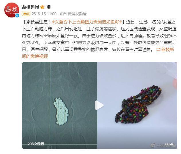 家长需注意！3岁女童吞下上百颗磁力珠肠道如鱼籽