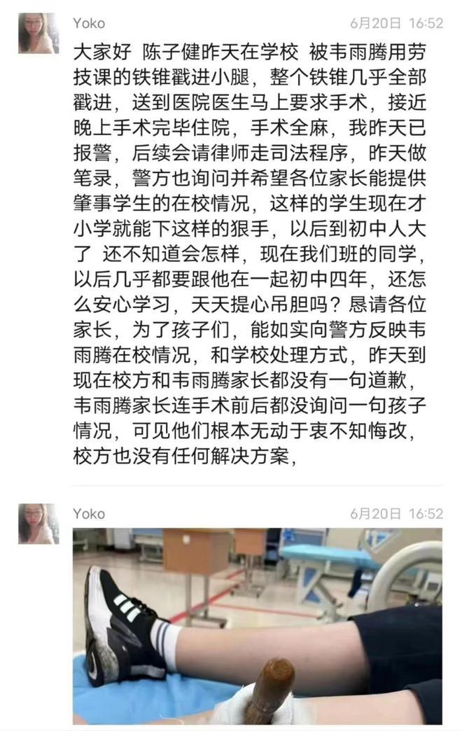 太可怕！男孩被同学用5厘米铁锥整个刺入小腿，伤人者多次霸凌