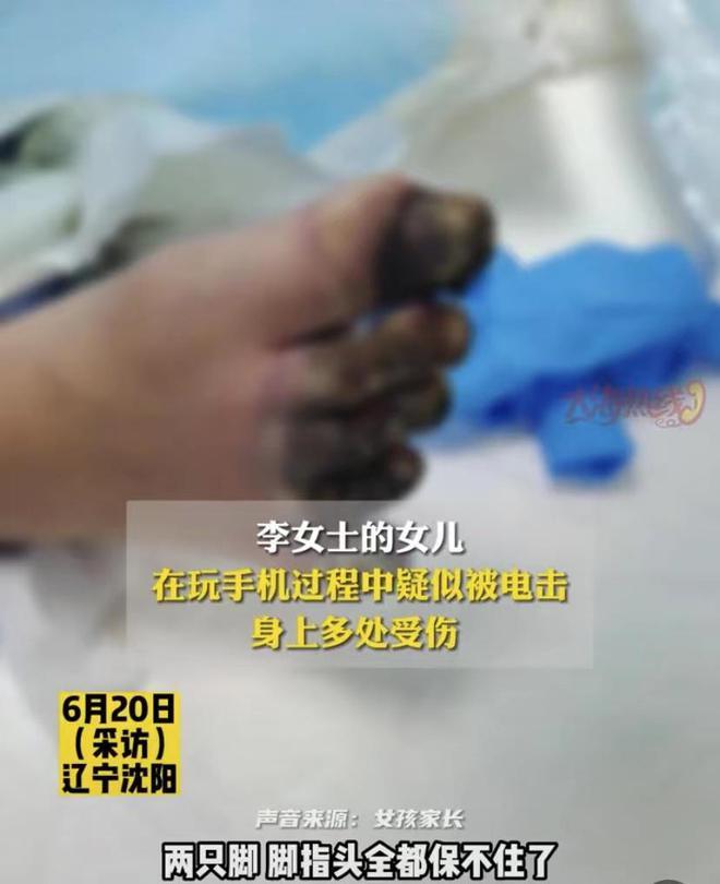 沈阳被电击女孩内脏受损，面临截肢。苹果：无法赔偿