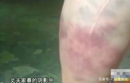 姐姐被丈夫家暴30年，娘家人去理论反被指责，妹妹：被姐夫打傻了