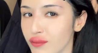 哈妮克孜被蚊子咬成香肠嘴