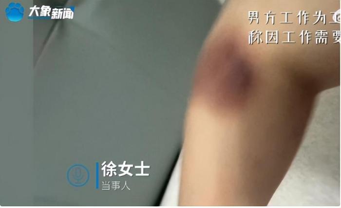 女子称坐月子期间遭丈夫家暴