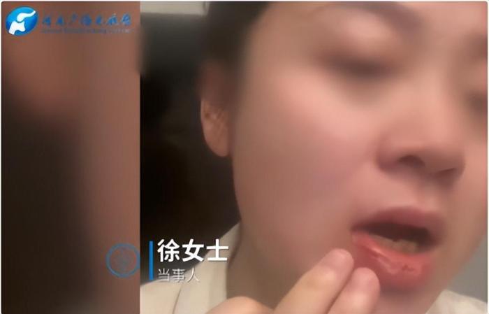 女子称坐月子期间遭丈夫家暴