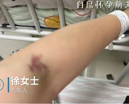 女子称坐月子期间遭丈夫家暴