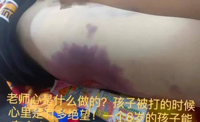 山东武术俱乐部8岁男童遭残忍虐打致死，凶手还拿尸体摆拍发视频