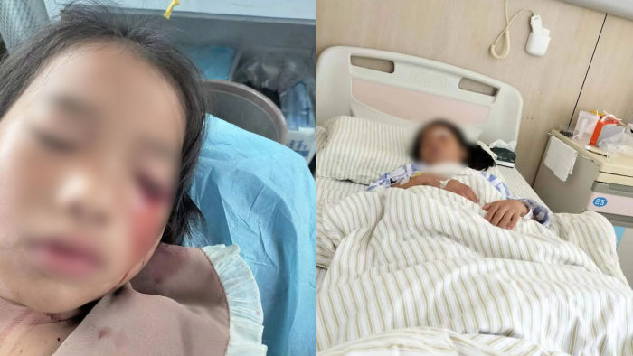 女子称8岁女儿被2男孩用弹弓打失明，对方家长不愿出面，警方介入