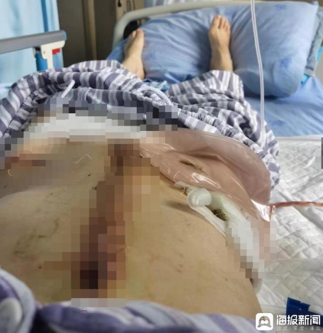 被家暴16次女子躲朋友家都被定位