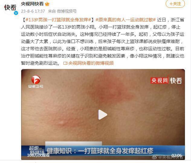 13岁男孩一打篮球就全身发痒原来真的有运动性过敏