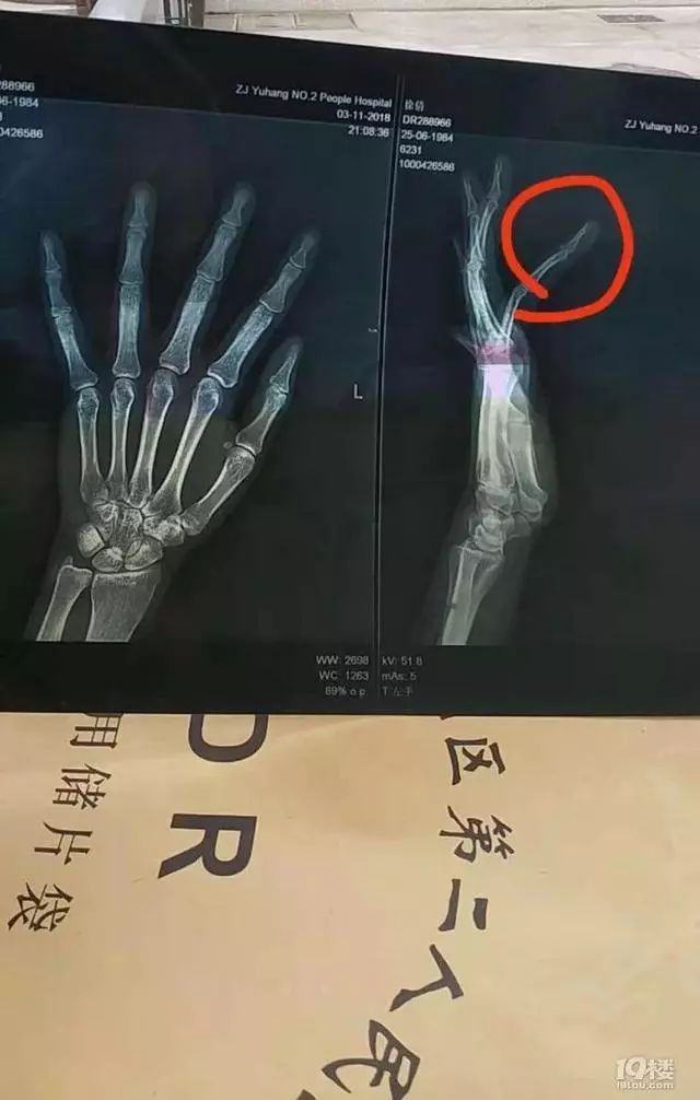 母亲为保护孩子遭到殴打