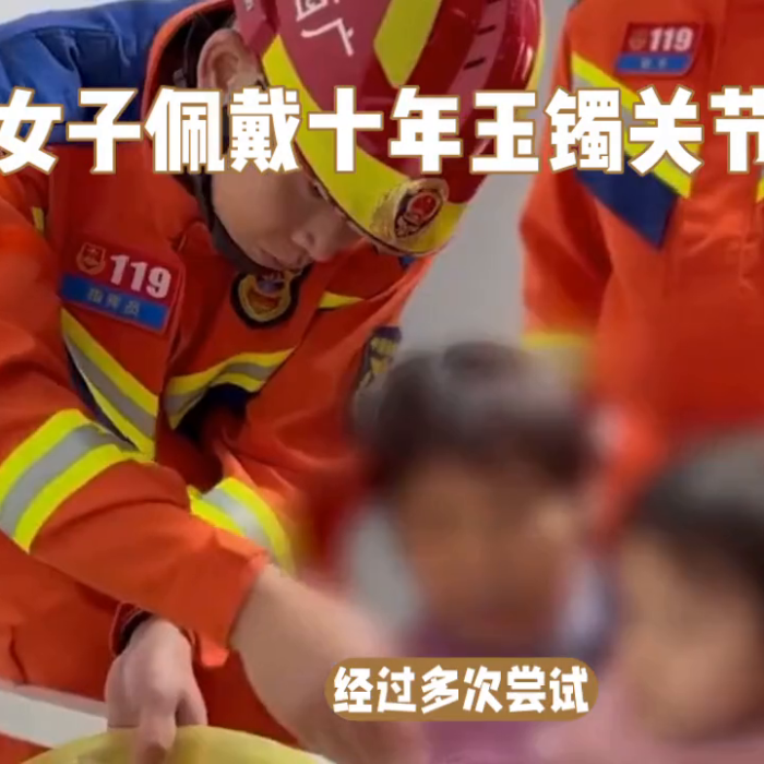 戴玉镯10年关节变形