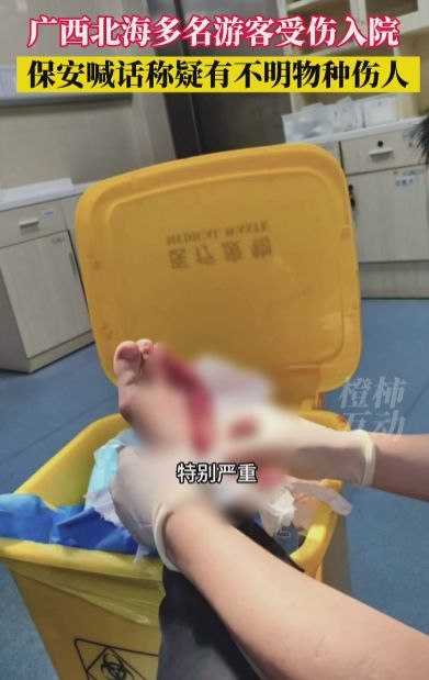 专家北海咬伤游客鱼类可能是魣类