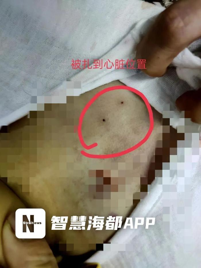 术后死亡女童家属医院隐瞒细节