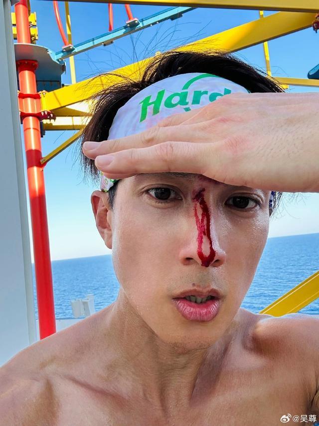 吴尊陪儿女打篮球受伤留疤血从鼻梁伤口流下仍淡定自拍