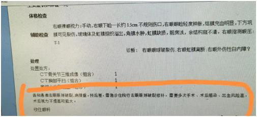 汽水爆炸致眼球破裂