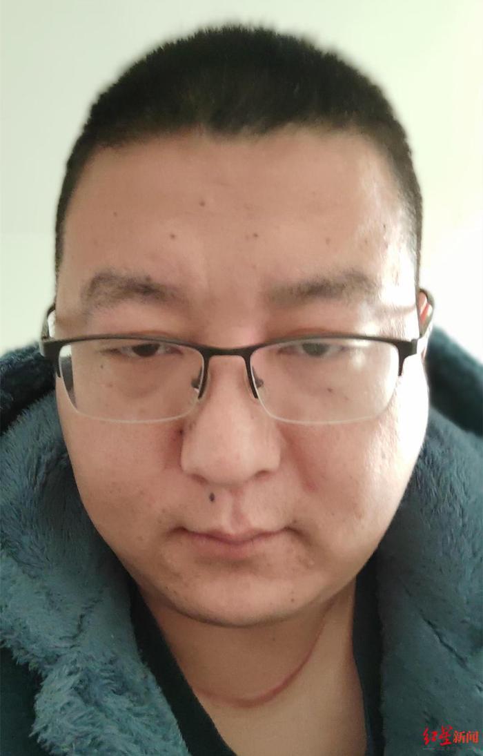 山东32岁患癌男子寻亲成功