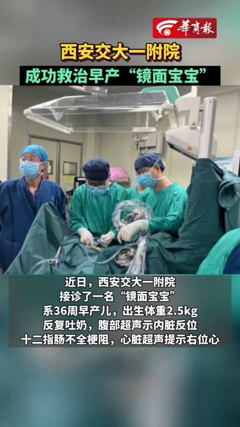 西安成功救治早产镜面宝宝