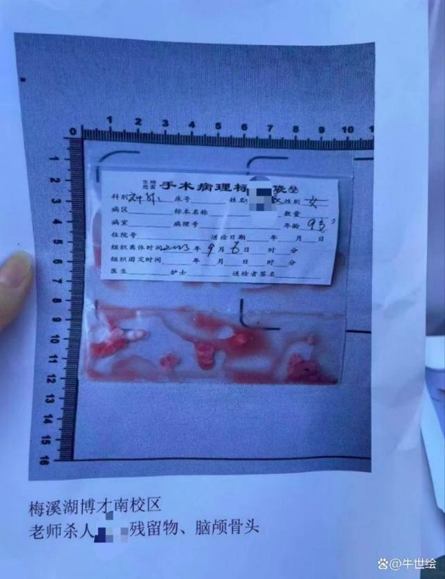打破学生头骨老师停职接受公安调查