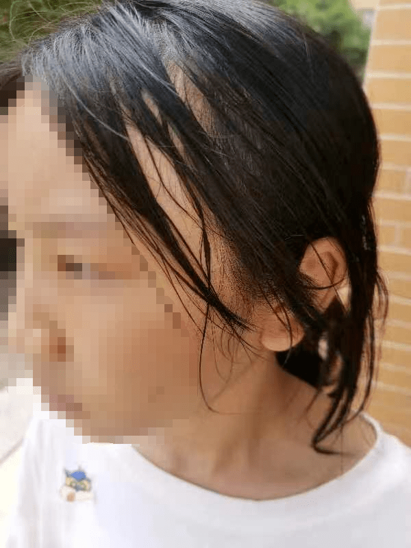 学生被老师掌掴耳膜穿孔学校回应