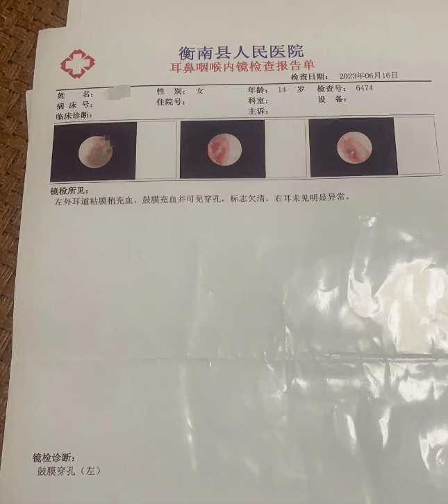 学生被老师掌掴耳膜穿孔学校回应