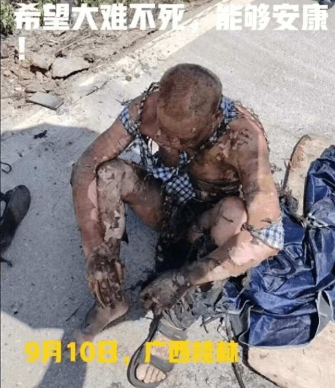 男子钓鱼碰到高压线全身烧焦