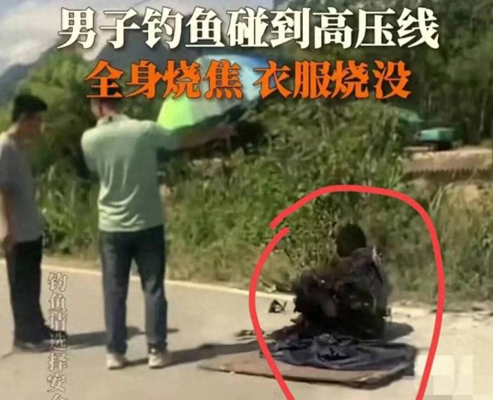 男子钓鱼碰到高压线全身烧焦
