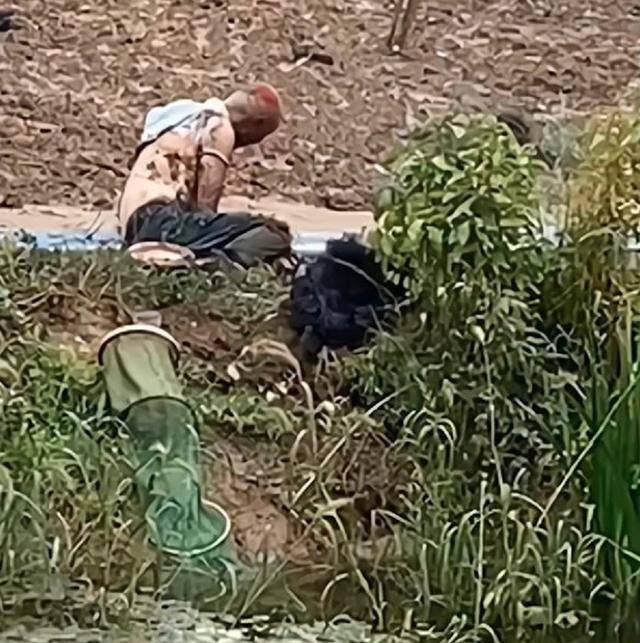 男子钓鱼误触碰高压电，衣服和头发都烧没了，脸变漆黑