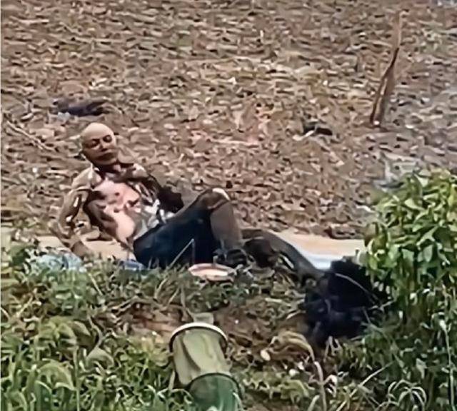 男子钓鱼误触碰高压电，衣服和头发都烧没了，脸变漆黑