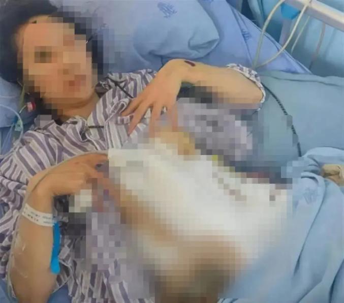 两年被丈夫家暴16次！疑似当事女子发声，成都多部门已介入