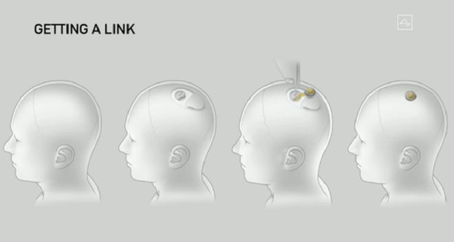 马斯克脑机公司将对人体试验，大脑中植入脑机接口，数字版永生？