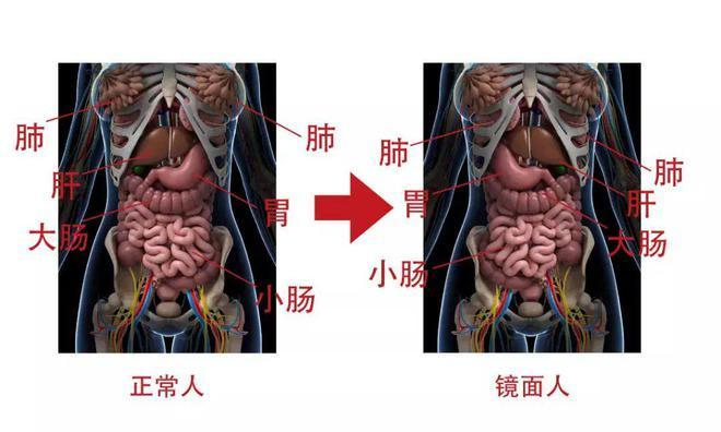 女子就医发现五脏六腑全长反