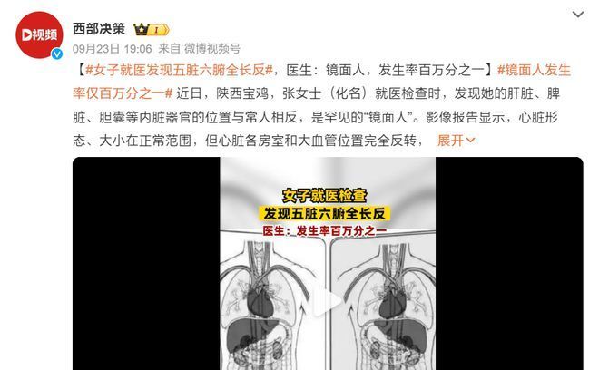 女子五脏六腑全长反