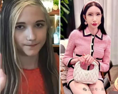 奥地利女网红整形成韩国美女缝了单眼皮网友称渗人