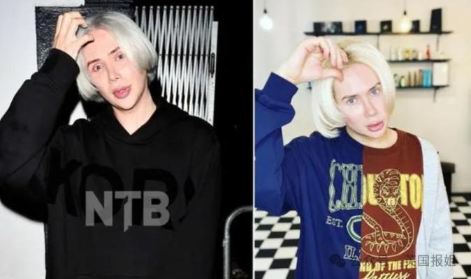 奥地利女网红整形成韩国美女缝了单眼皮网友称渗人