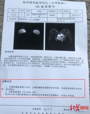 做隆胸的招牌医生竟是口腔专业？女子术后假体破裂
