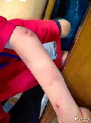 围棋少年坠亡其父首度发声：儿子并非输不起