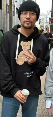 周杰伦患强直性脊柱炎，近照曝光弯腰驼背走路缓慢