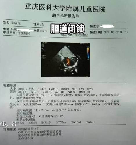 两个月女婴生命垂危，父亲捐肝相救，术后复发恶性肿瘤晚期