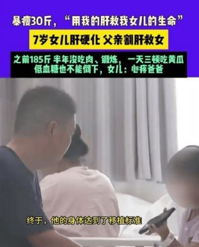 河南父亲割肝救女：减重八个月成功实施肝移植